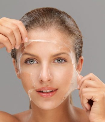 Peeling